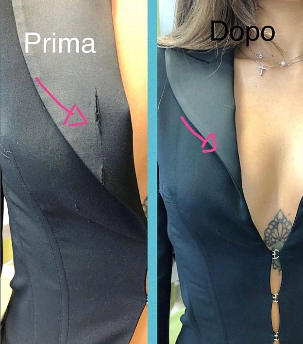 Riparazione Giacca Strappata a Milano